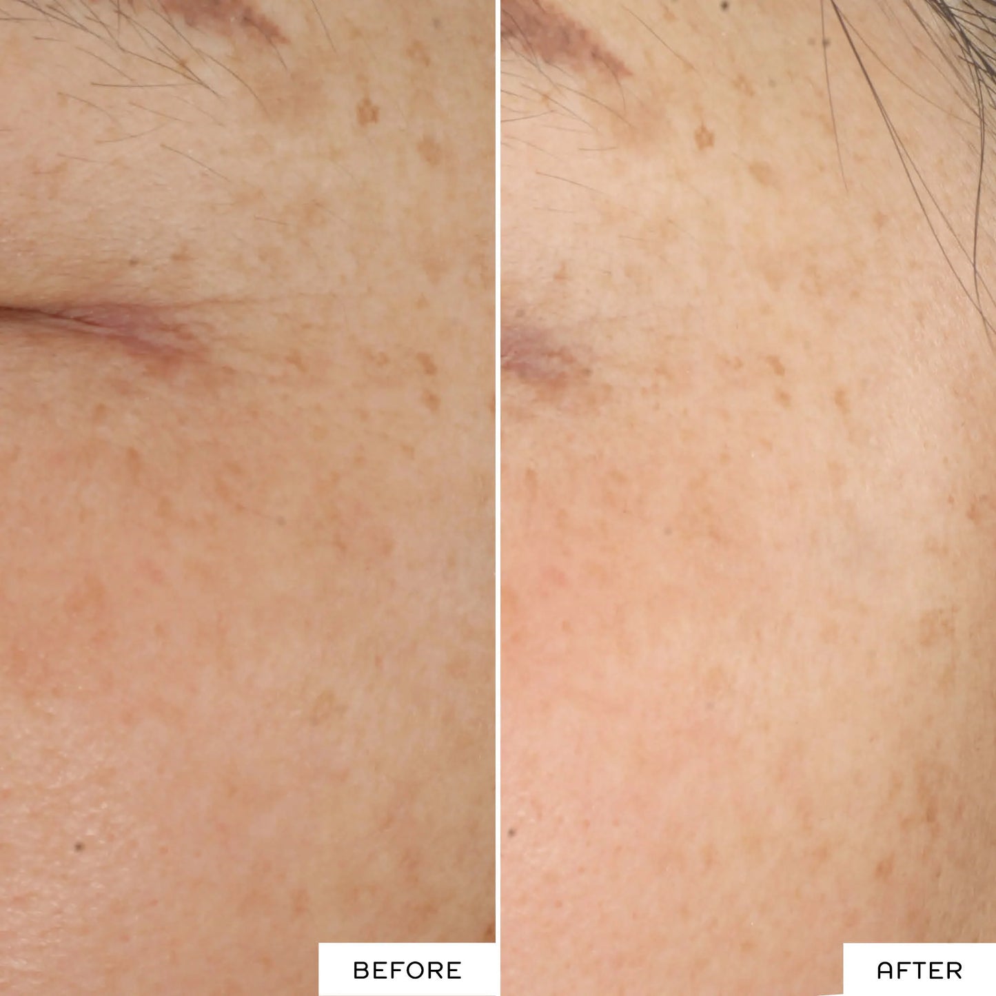 MINI RADIANCE OVERNIGHT GLOW DARK SPOT SLEEPING CREAM