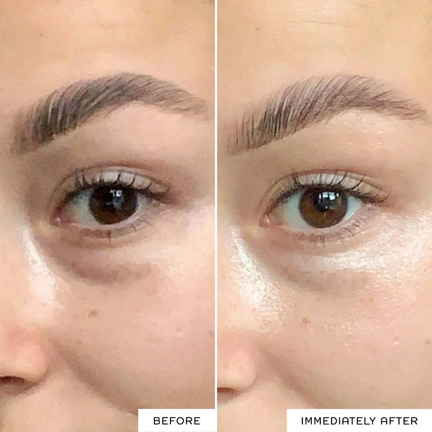 MINI RADIANCE BRIGHTENING DARK CIRCLE EYE CREAM