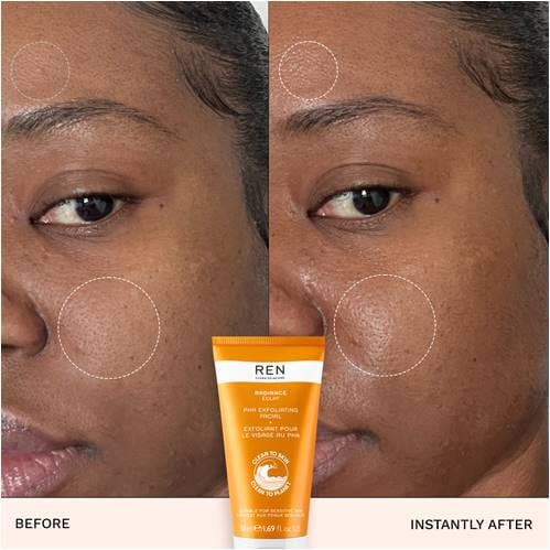 RADIANCE PHA EXFOLIATING FACIAL