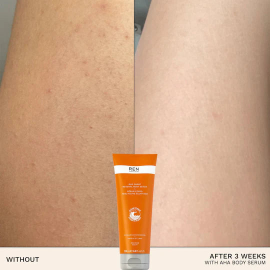 RADIANCE AHA SMART RENEWAL BODY SERUM