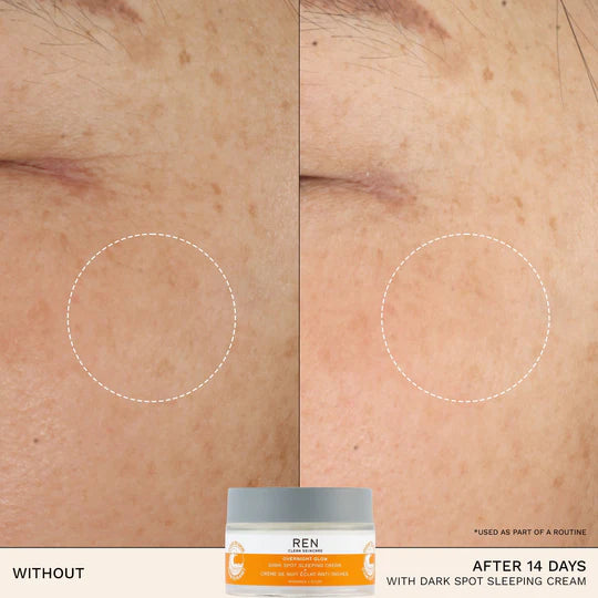 RADIANCE OVERNIGHT GLOW DARK SPOT SLEEPING CREAM