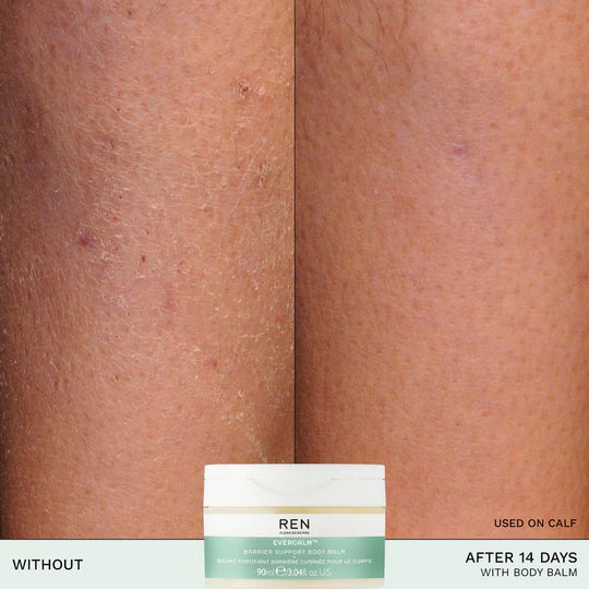 EVERCALM™ BARRIER SUPPORT BODY BALM