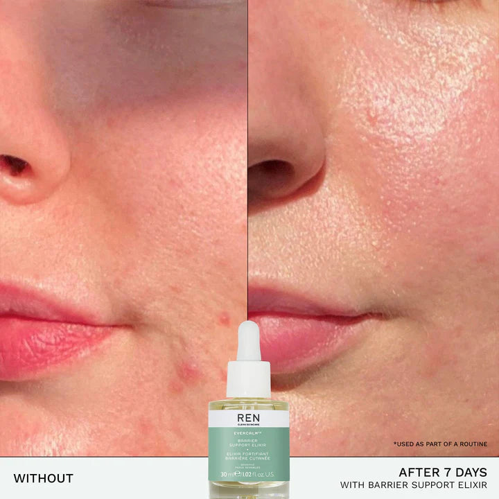 EVERCALM™ BARRIER SUPPORT ELIXIR