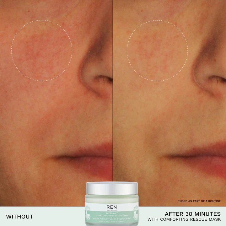 EVERCALM™ ULTRA COMFORTING RESCUE MASK