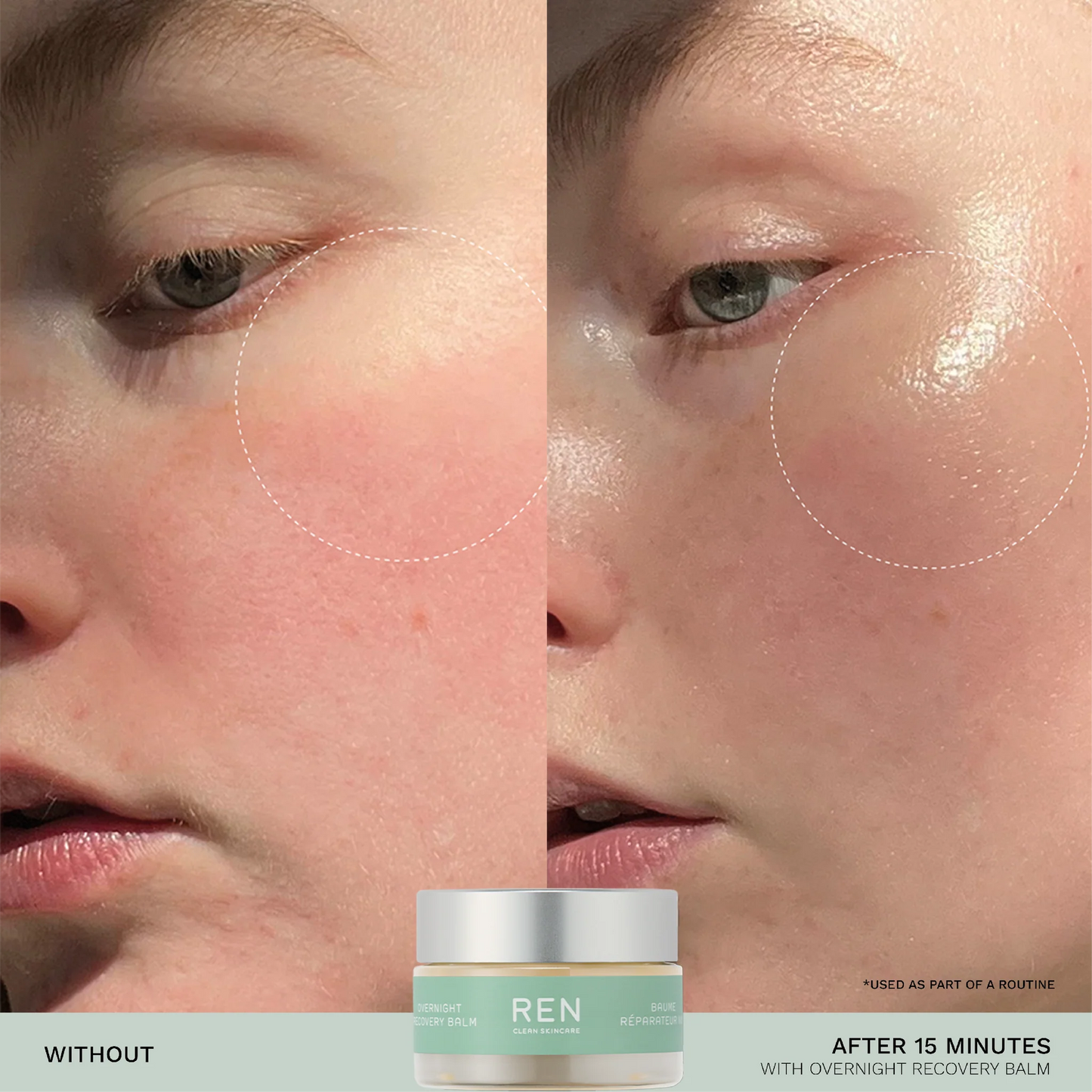 Evercalm™ Sensitive Skin Heroes Starter Kit