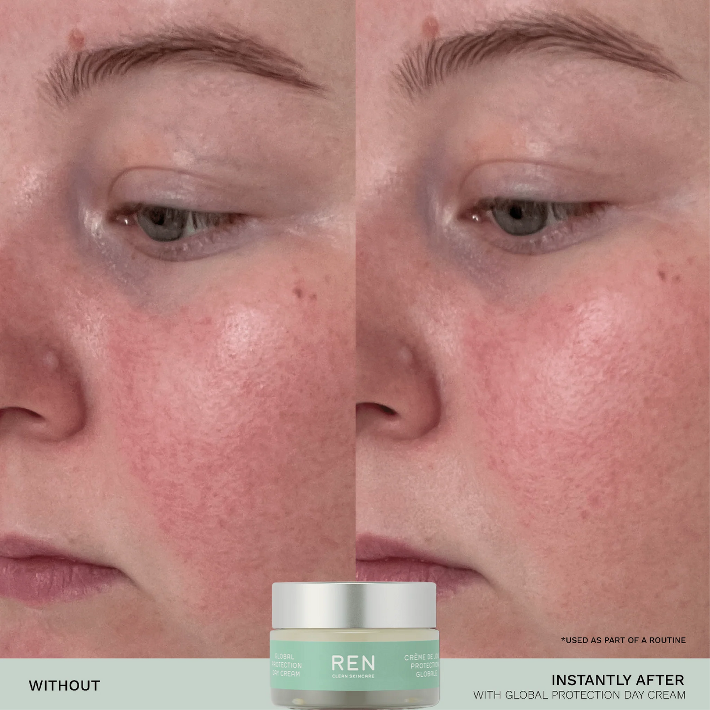 Evercalm™ Sensitive Skin Heroes Starter Kit